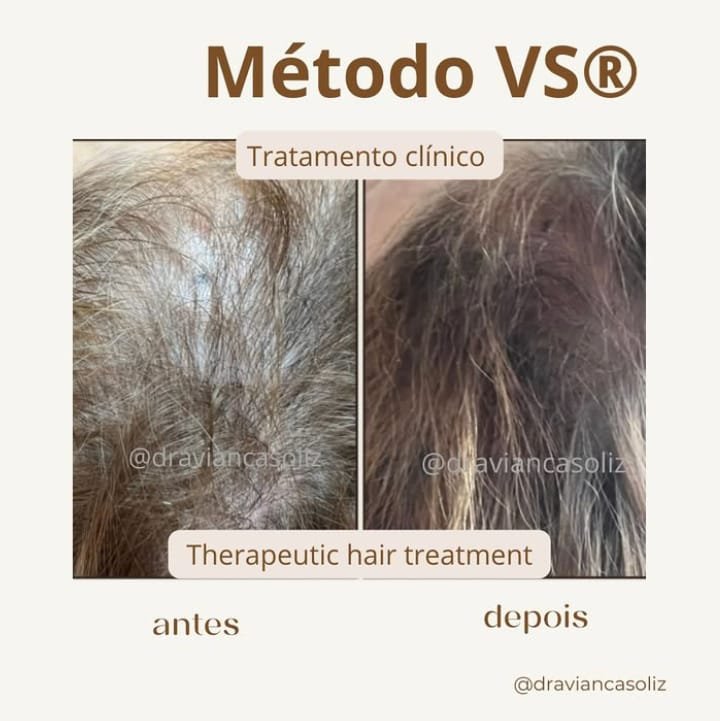 Antes y después capilar 6